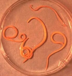 Asscaride man parasites