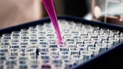 How to pass tests for the detection of parasites in the body