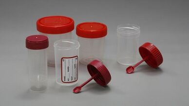 How to prepare for the parasites test