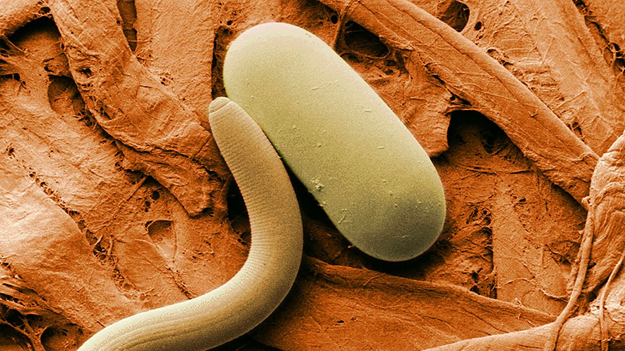 Parasites under the microscope